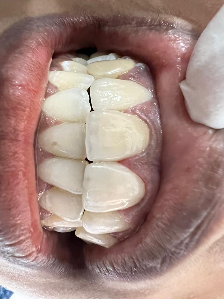 SMILE STONE DENTAL CLINIC CHEVARAMBALAM