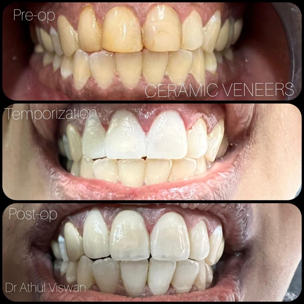 SMILE STONE DENTAL CLINIC CHEVARAMBALAM