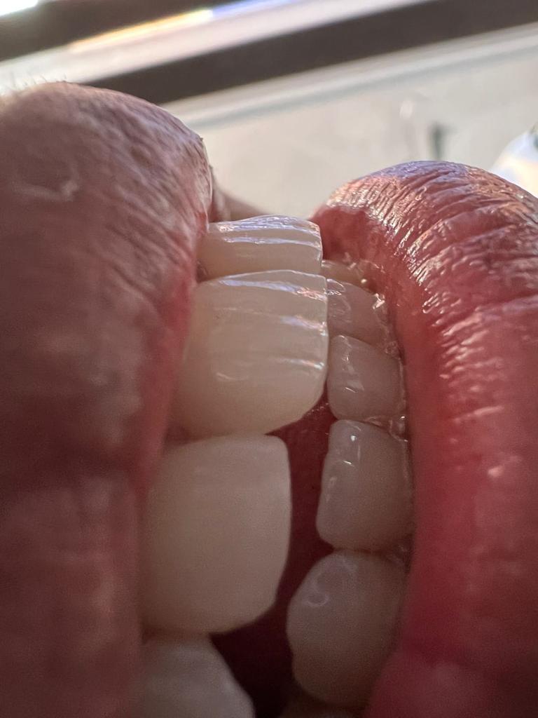 SMILE STONE DENTAL CLINIC CHEVARAMBALAM