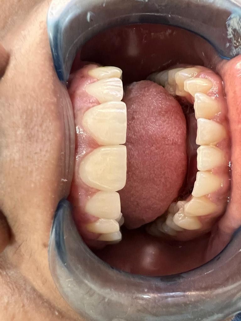 SMILE STONE DENTAL CLINIC CHEVARAMBALAM