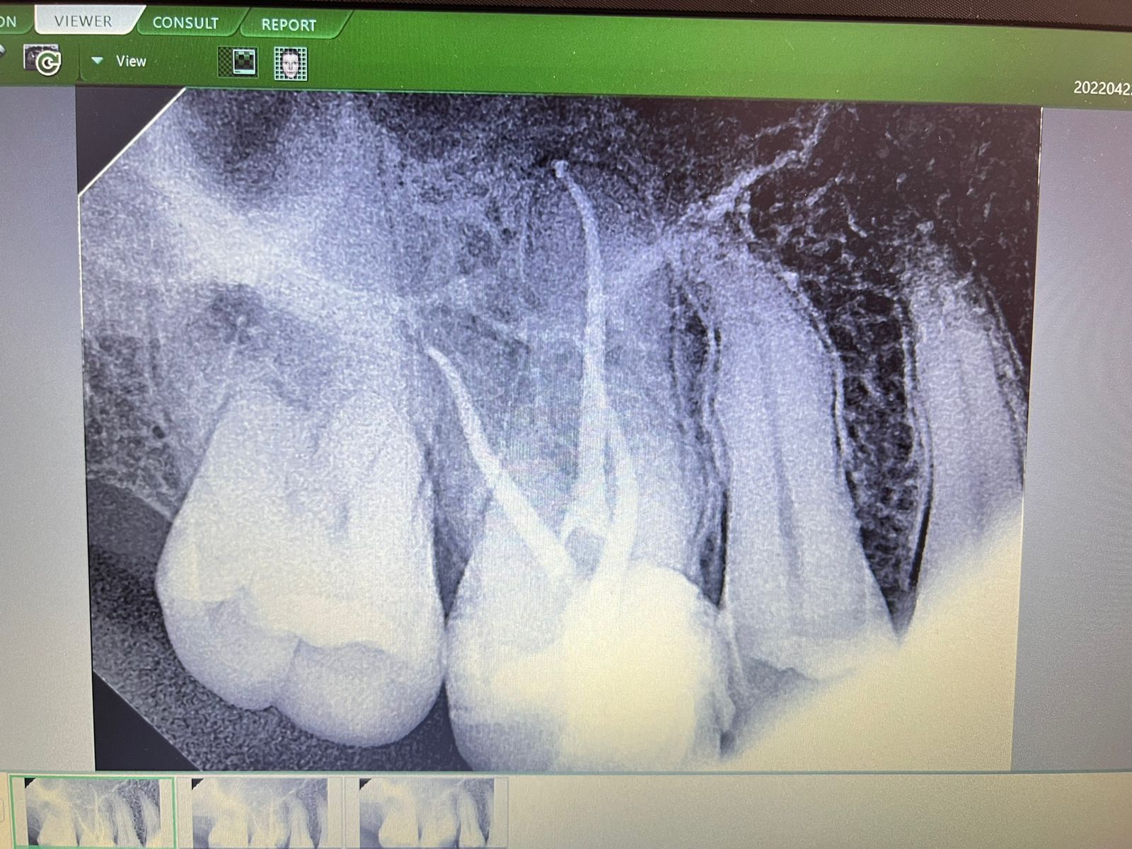 SMILE STONE DENTAL CLINIC CHEVARAMBALAM
